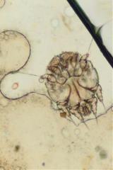 scabieundermicroscope